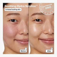 Dermask Soothing Hydra Solution Pro Sheet Masks Pack - 5 Masks x 26g