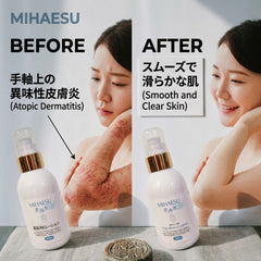 Before and after comparison of skin with MIHAESU product, showing smooth and clear skin.
