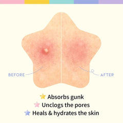 Hydrocolloid star pimple patch – Korean blemish solution