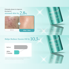 Applying Medicube azelaic acid serum to calm redness and improve skin texture