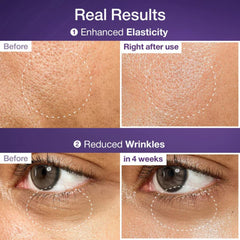 Before and after effects of a skincare product on skin texture and wrinkles.numbuzin No9 NAD Bio Lifting Essence anti aging serum Korea-NadBio skincare essence bottle |THE COSMETIC STORE NZ