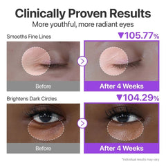 Before and after effects of eye cream treatment with clinical results shown. numbuzin No.9 NAD+ Retinol Volumetox Eye Cream-Filler for Youthful-THE COSMETIC STORE NZ.