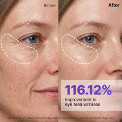 Before and after comparison of eye area wrinkles with a 116.12% improvement shown.-SUNGBOON EDITOR Silk Peptide EGF Intensive Gold Mask