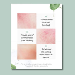 MD’S PICK Tecateca Calming Serum soothing hydrating repair serum for sensitive skin