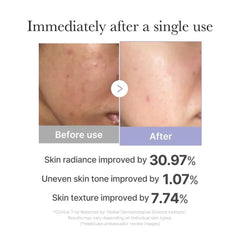 Age-R Booster Pro Mini White- Mother’s Day BOGO Set [Buy 1 get 1 Free]-Before and after skin comparison with text indicating improvement percentages.