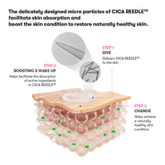 Reedle Shot 100 2-Step Mask