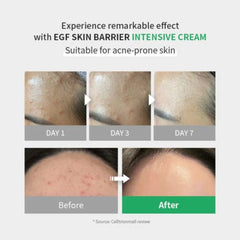 EGF Skin Barrier Intensive Cream 80ml