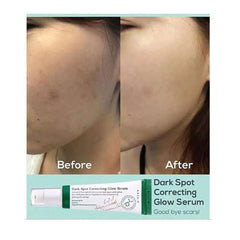 AXIS-Y serum for dark spot correction and radiant skin