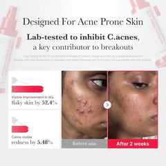 Hypochlorous Acid Daily Facial Spray 125ml