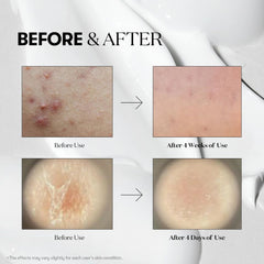 Reedle Shot 300 50ml