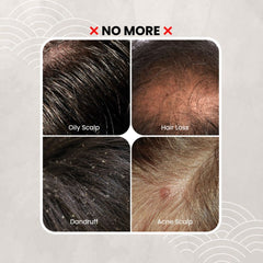 A before-and-after style graphic with four close-up scalp photos arranged in a grid under the text 'NO MORE' with red X marks. The top-left panel shows oily scalp, the top-right shows hair loss, the bottom-left shows dandruff, and the bottom-right shows acne scalp.- Yanagiya Hair Tonic Citrus 240ml- THE COSMETIC STORE NZ