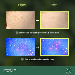 Anua Heartleaf 77 Clear Pad 70 Sheets for Sensitive Skin- The Cosmetic Store New Zealand