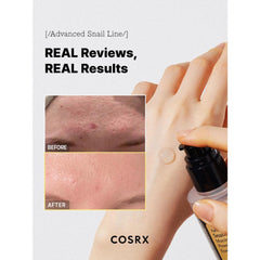 COSRX-Snail 96 Mucin Essence 100ml – Repair & Hydrate- The Cosmetic Store New Zealand