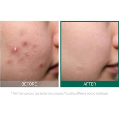 AHA/BHA/PHA 30 Days Miracle Cream - The Cosmetic Store New Zealand